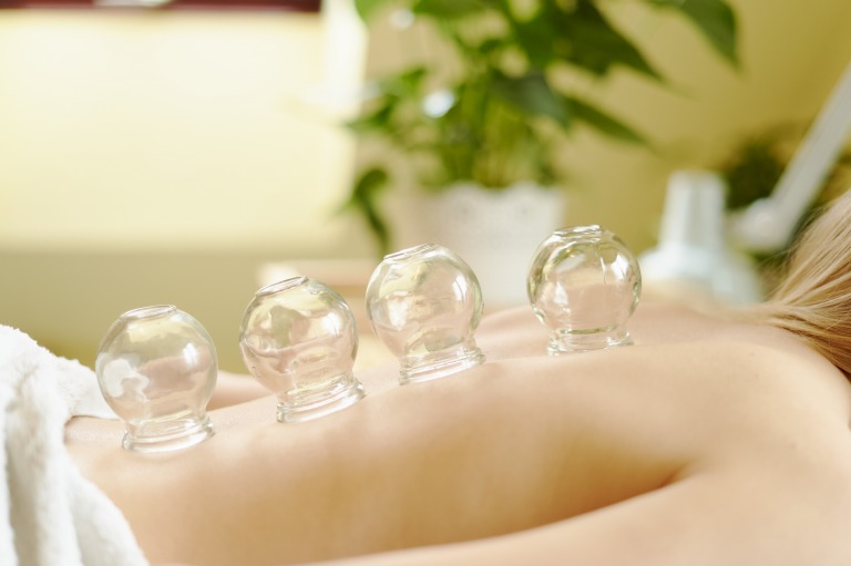 カッピング・カップドレナージュ